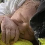 Out on a Limb: A Tree Surgeon Delivers a Baby