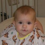 The Baby with a Cleft Lip