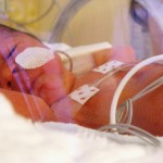 When a Micropreemie Grows Up