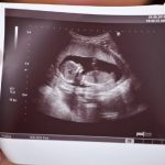 My Miraculous Birth by Rabbi Fischel Schachter